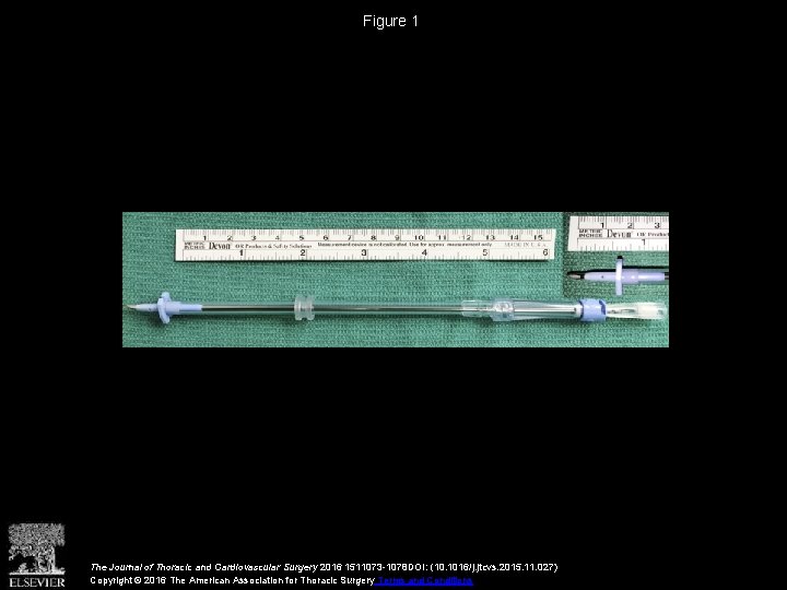 Figure 1 The Journal of Thoracic and Cardiovascular Surgery 2016 1511073 -1078 DOI: (10.