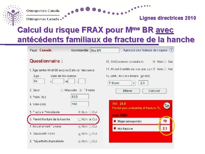 Lignes directrices 2010 Calcul du risque FRAX pour Mme BR avec antécédents familiaux de
