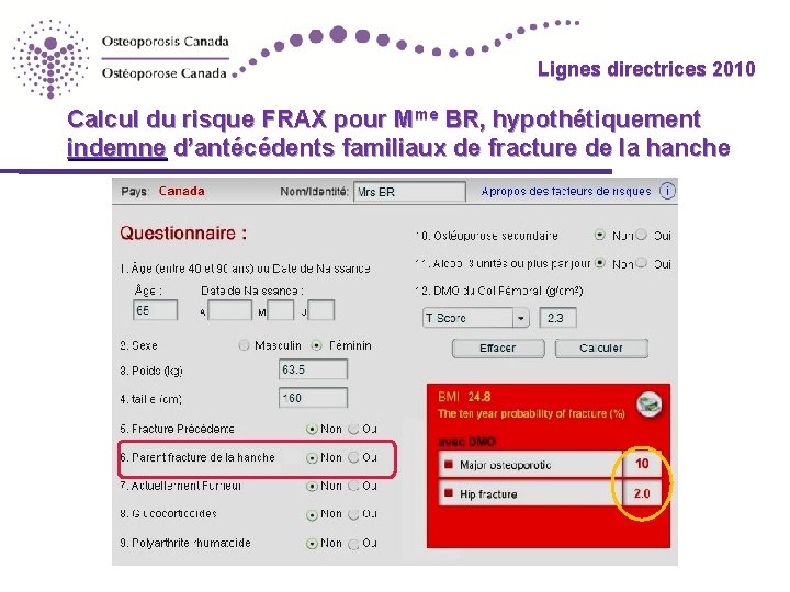 Lignes directrices 2010 Calcul du risque FRAX pour Mme BR, hypothétiquement indemne d’antécédents familiaux