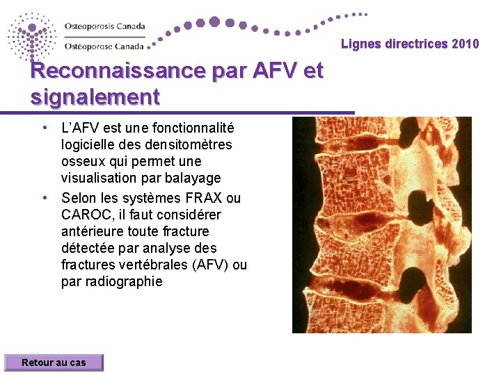 Lignes directrices 2010 Reconnaissance par AFV et signalement • L’AFV est une fonctionnalité logicielle