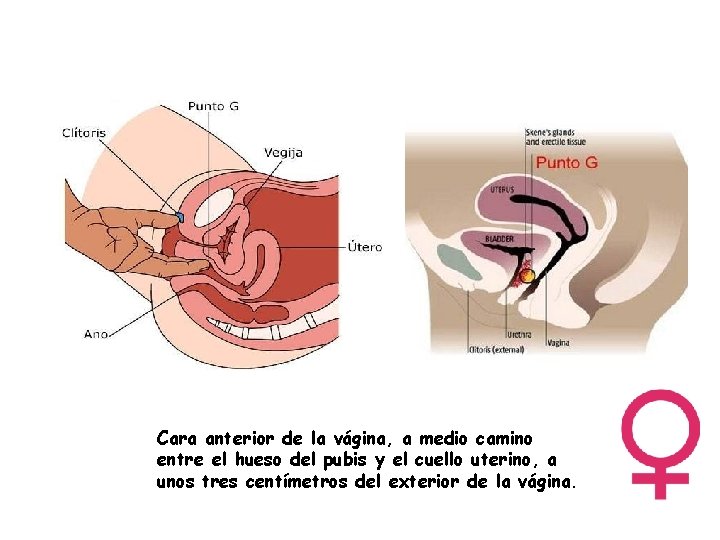 Cara anterior de la vágina, a medio camino entre el hueso del pubis y