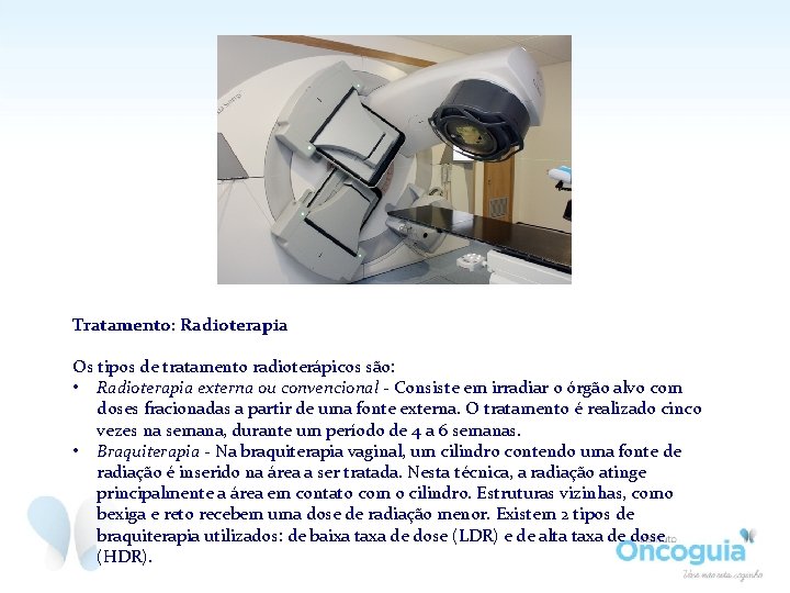 Tratamento: Radioterapia Os tipos de tratamento radioterápicos são: • Radioterapia externa ou convencional - Tratamento: Radioterapia Os tipos de tratamento radioterápicos são: • Radioterapia externa ou convencional -