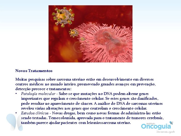 Novos Tratamentos Muitas pesquisas sobre sarcoma uterino estão em desenvolvimento em diversos centros médicos Novos Tratamentos Muitas pesquisas sobre sarcoma uterino estão em desenvolvimento em diversos centros médicos