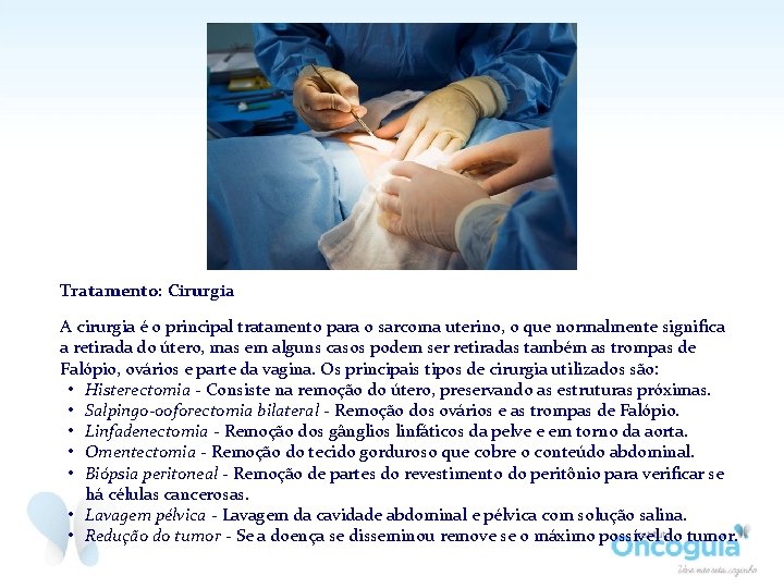 Tratamento: Cirurgia A cirurgia é o principal tratamento para o sarcoma uterino, o que Tratamento: Cirurgia A cirurgia é o principal tratamento para o sarcoma uterino, o que