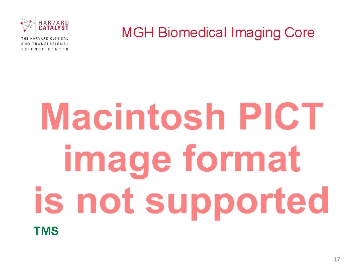 MGH Biomedical Imaging Core TMS 17 