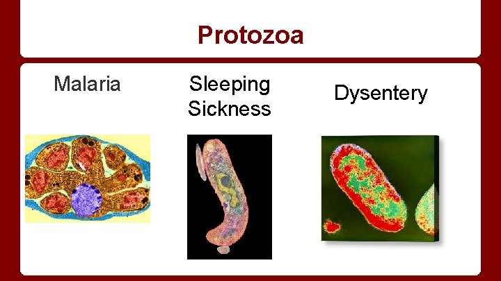 Protozoa Malaria Sleeping Sickness Dysentery 