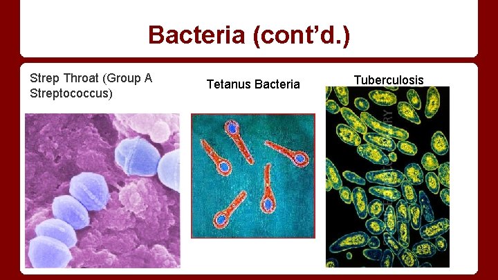 Bacteria (cont’d. ) Strep Throat (Group A Streptococcus) Tetanus Bacteria Tuberculosis 