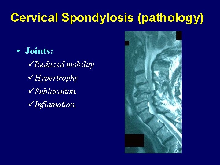 Cervical Spondylosis (pathology) • Joints: üReduced mobility üHypertrophy üSublaxation. üInflamation. 