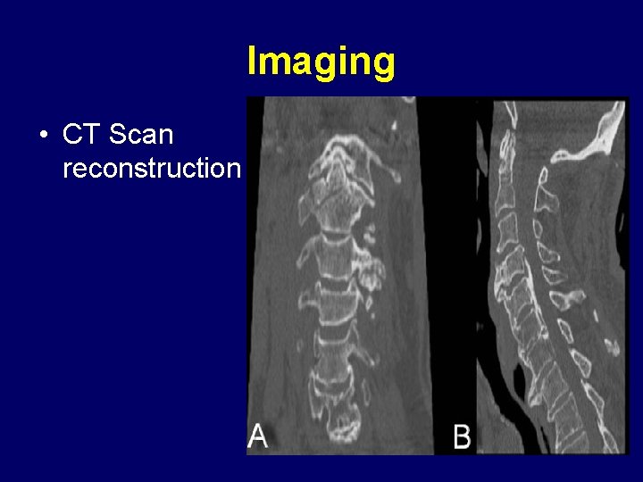 Imaging • CT Scan reconstruction 