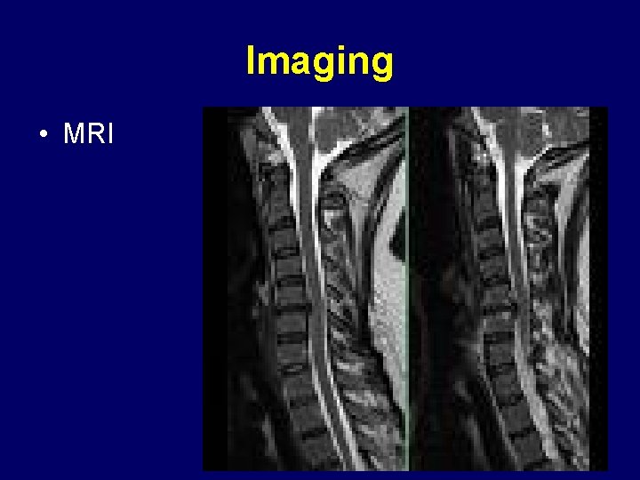 Imaging • MRI 