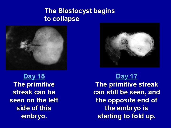 The Blastocyst begins to collapse Day 15 The primitive streak can be seen on