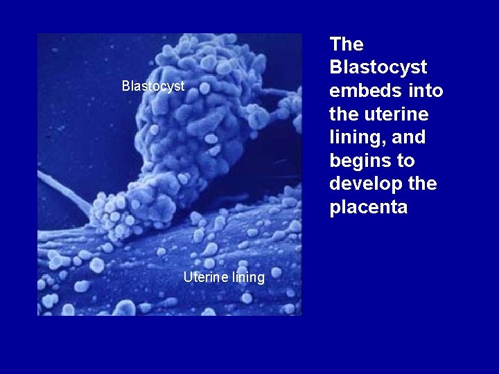 Blastocyst Uterine lining The Blastocyst embeds into the uterine lining, and begins to develop