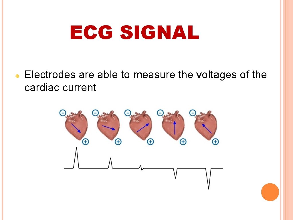 ECG SIGNAL Electrodes are able to measure the voltages of the cardiac current 