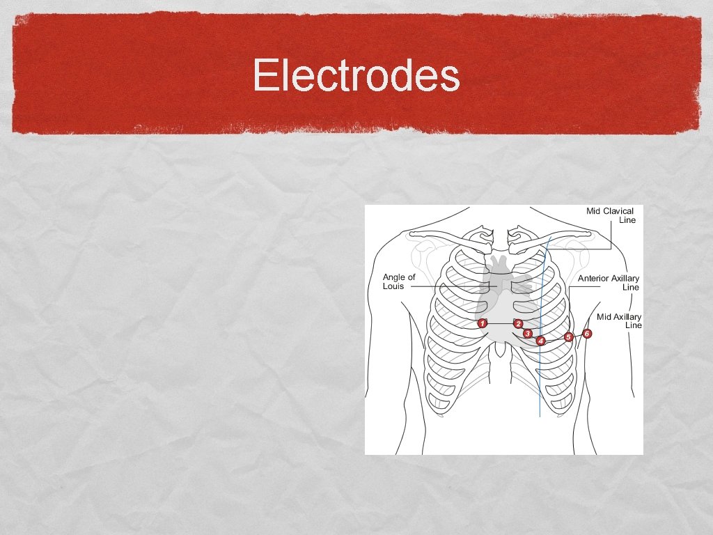 Electrodes 