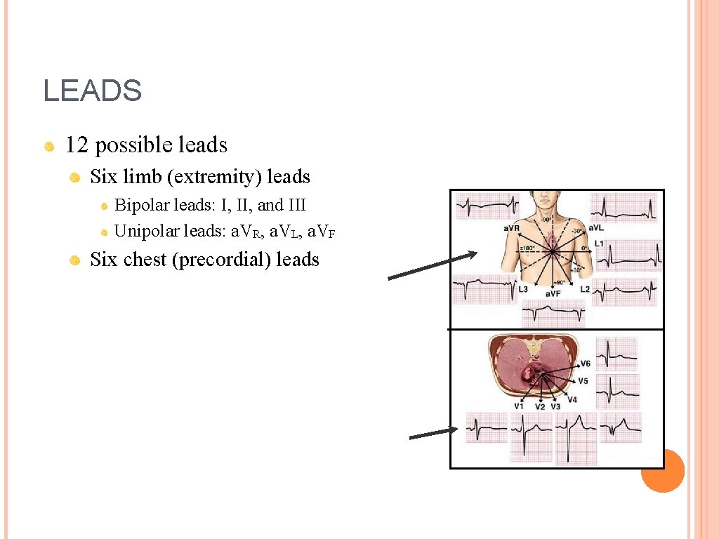 LEADS 12 possible leads Six limb (extremity) leads Bipolar leads: I, II, and III