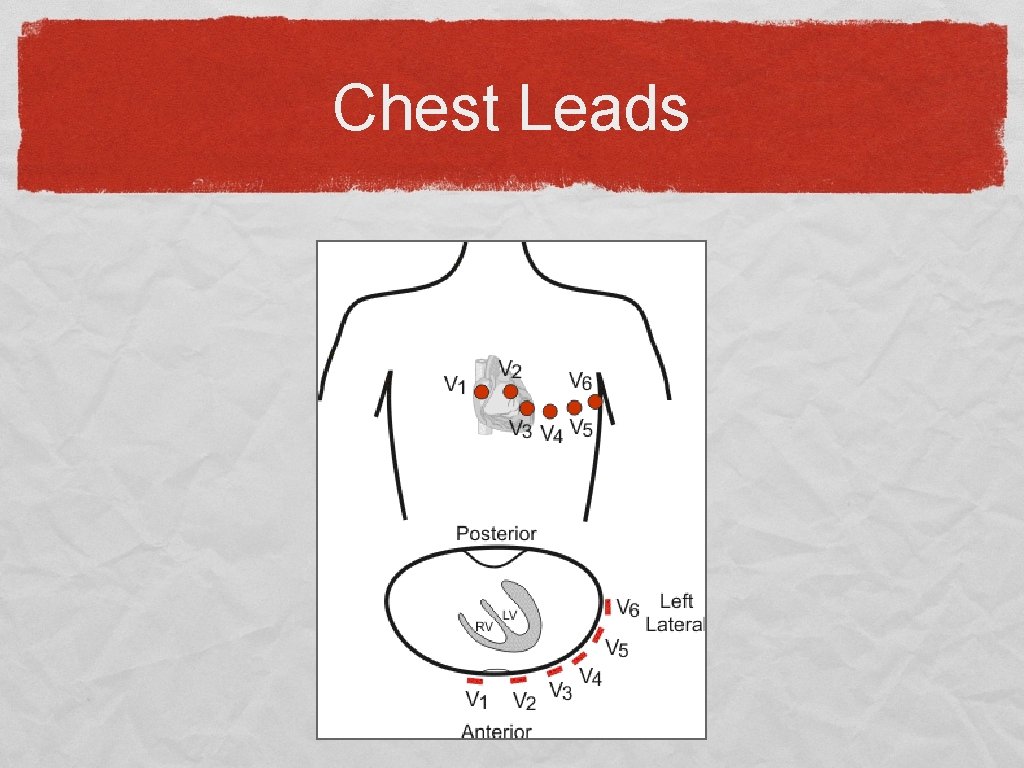 Chest Leads 