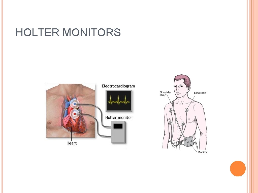 HOLTER MONITORS 