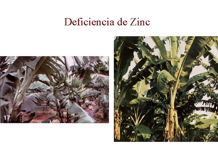 Deficiencia de Zinc 