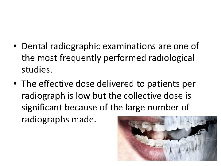  • Dental radiographic examinations are one of the most frequently performed radiological studies.