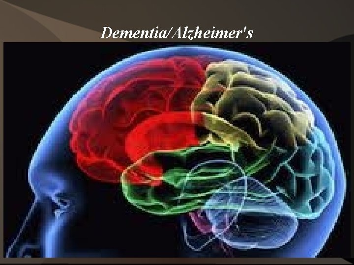 Dementia/Alzheimer's 78 