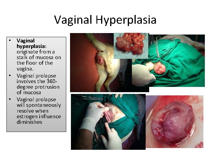 Vaginal Hyperplasia • Vaginal hyperplasia: originate from a stalk of mucosa on the floor