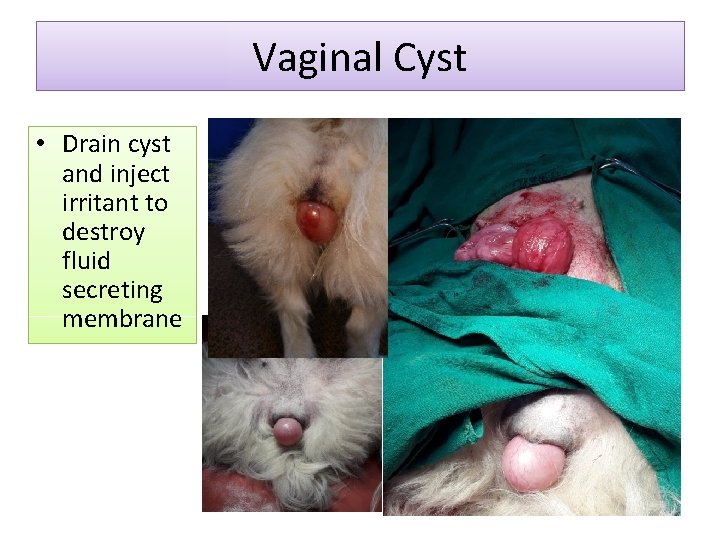 Vaginal Cyst • Drain cyst and inject irritant to destroy fluid secreting membrane 