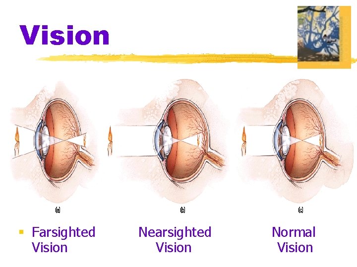 Vision § Farsighted Vision Nearsighted Vision Normal Vision 