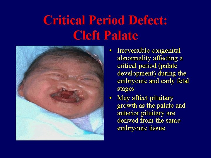 Critical Period Defect: Cleft Palate • Irreversible congenital abnormality affecting a critical period (palate