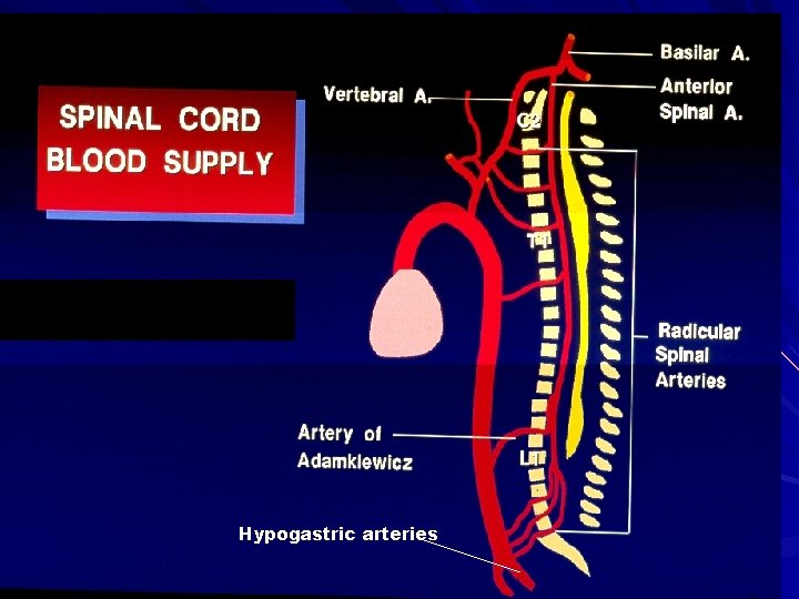 Hypogastric arteries 