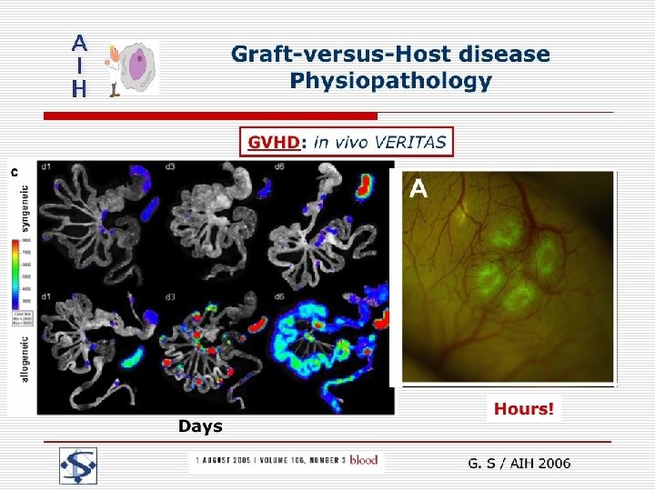 Graft-versus-Host disease Physiopathology G. S / AIH 2006 