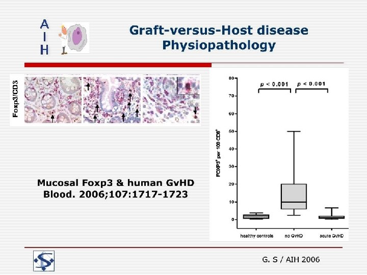 Graft-versus-Host disease Physiopathology G. S / AIH 2006 