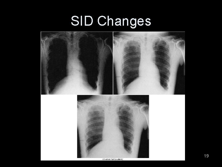 SID Changes 19 