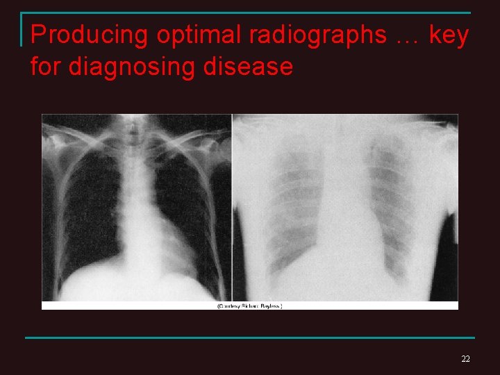 Producing optimal radiographs … key for diagnosing disease 22 