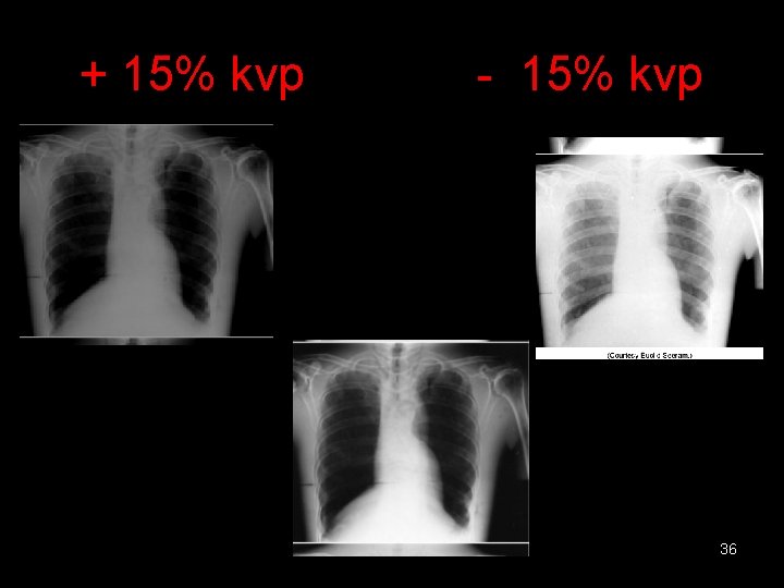 + 15% kvp - 15% kvp 36 