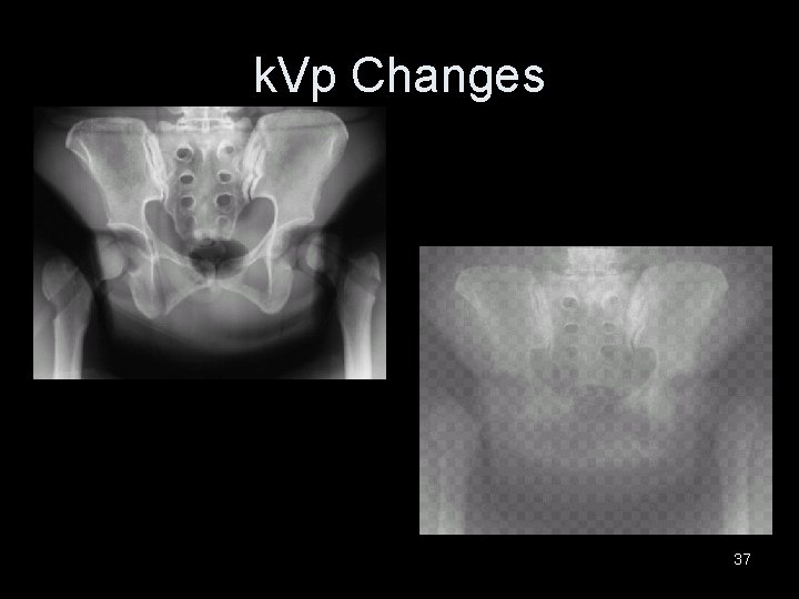 k. Vp Changes 37 