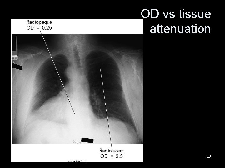 OD vs tissue attenuation 48 