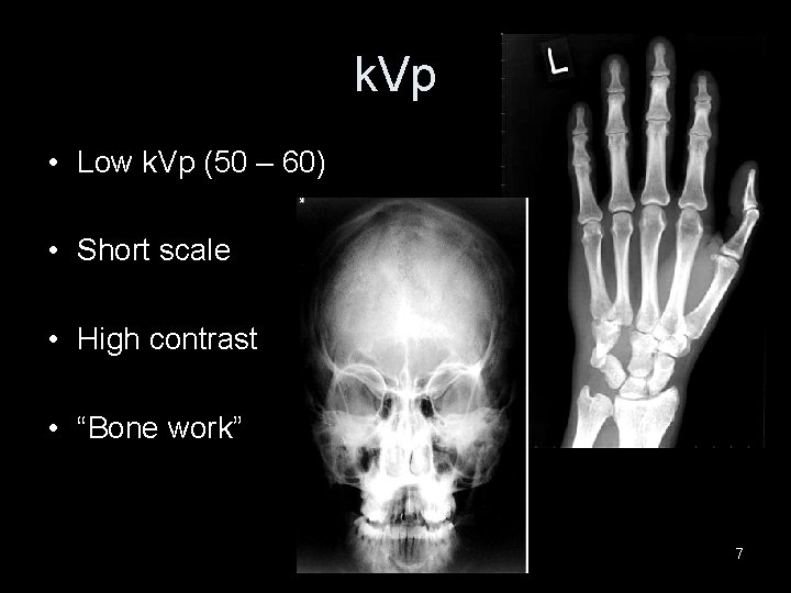 k. Vp • Low k. Vp (50 – 60) • Short scale • High