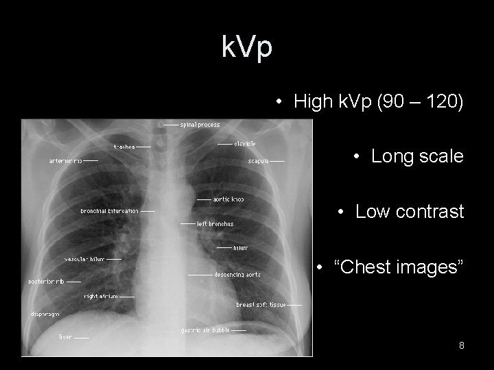 k. Vp • High k. Vp (90 – 120) • Long scale • Low