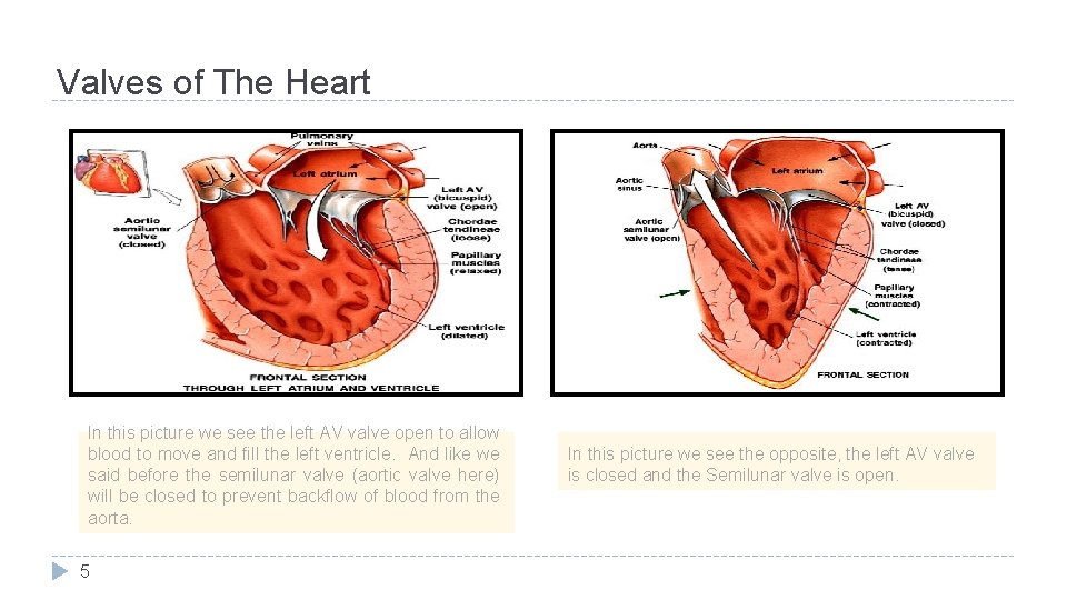 Valves of The Heart In this picture we see the left AV valve open