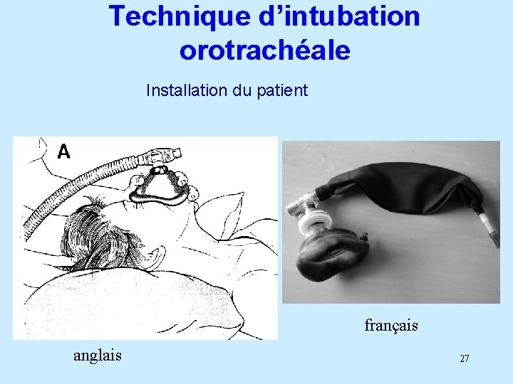 Technique d’intubation orotrachéale Installation du patient français anglais 27 