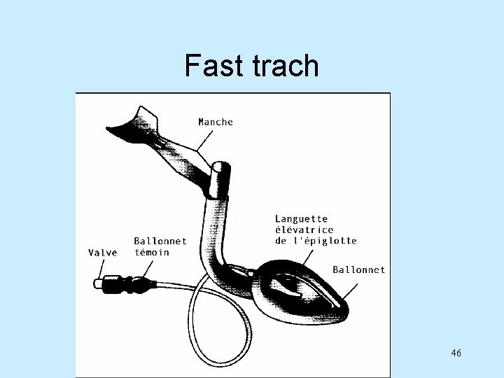 Fast trach 46 