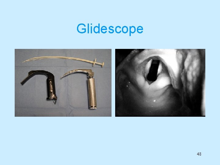 Glidescope 48 