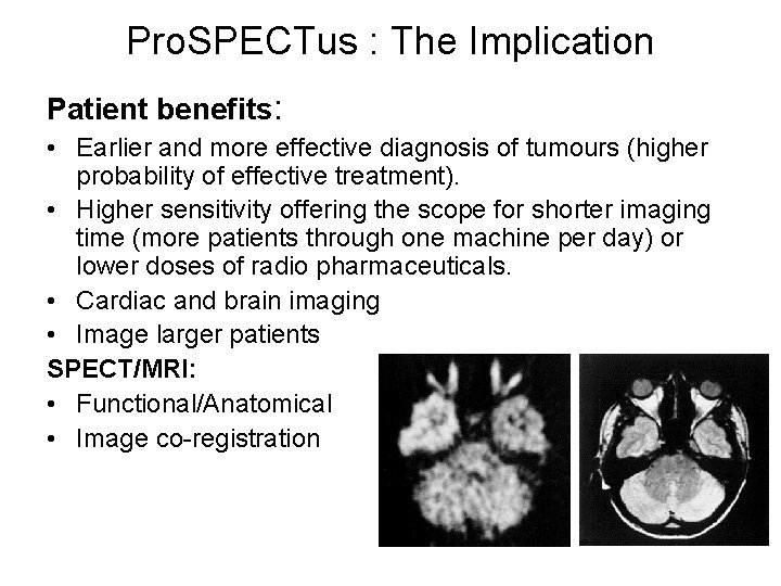 Pro. SPECTus : The Implication Patient benefits: • Earlier and more effective diagnosis of