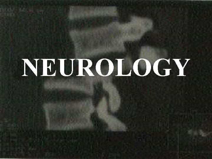 NEUROLOGY 