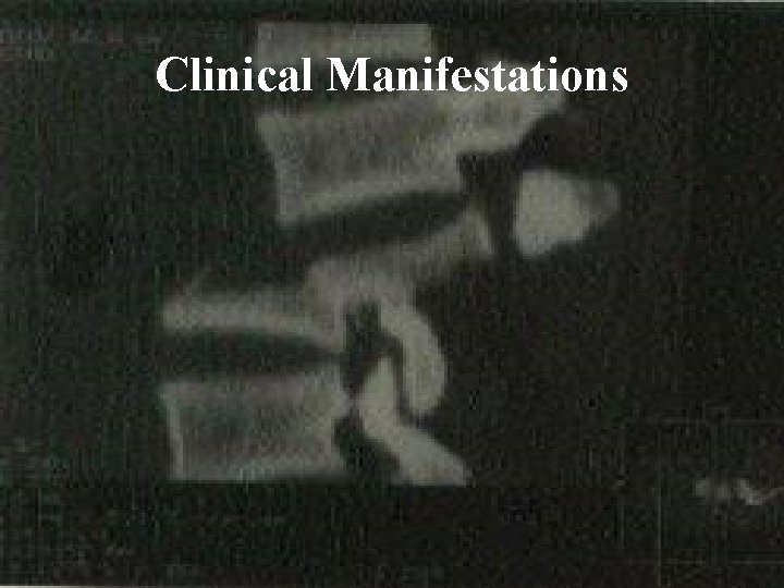 Clinical Manifestations 