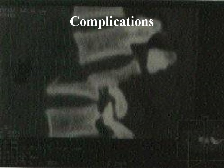 Complications 