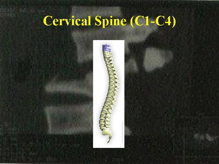 Cervical Spine (C 1 -C 4) 