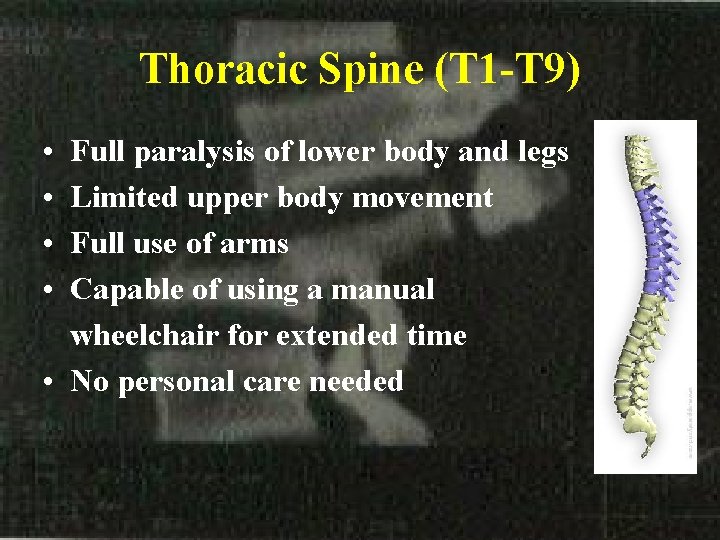 Thoracic Spine (T 1 -T 9) • • Full paralysis of lower body and