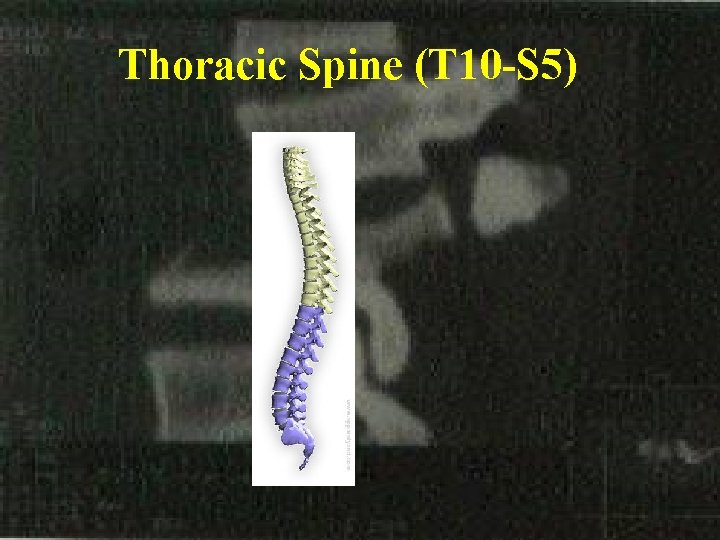 Thoracic Spine (T 10 -S 5) 