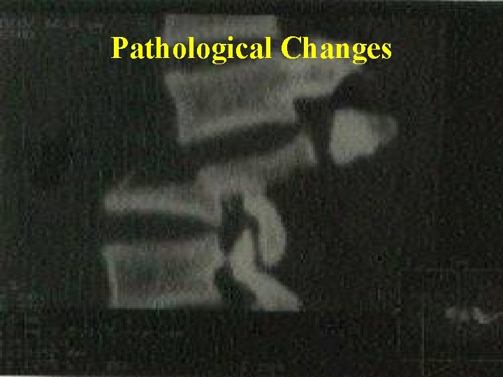 Pathological Changes 